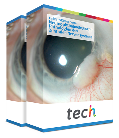 Universitätsexperte in Neuroophthalmologische Pathologien des Zentralen