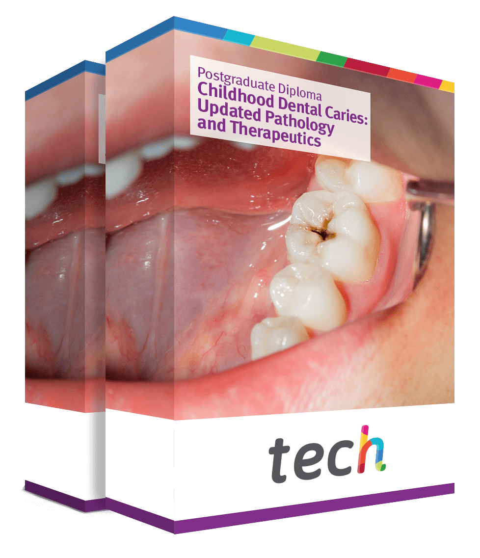 Postgraduate Diploma in Childhood Dental Caries Updated Pathology and