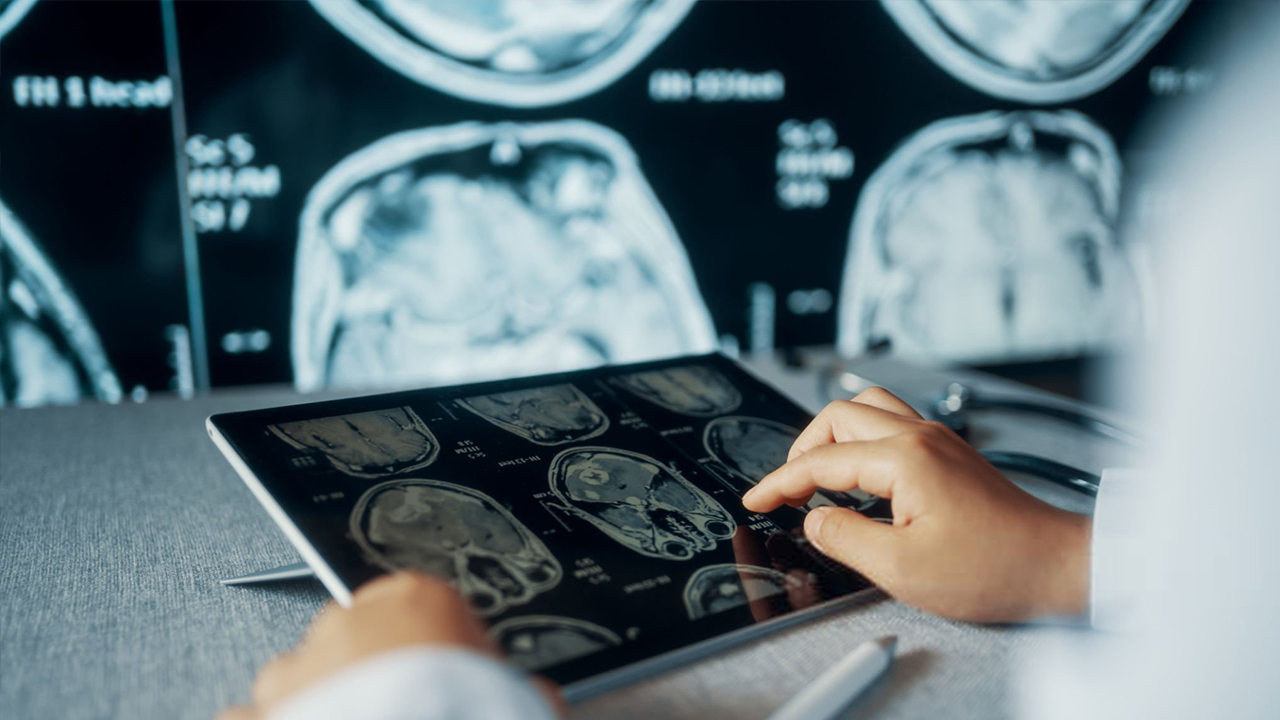 Maestría en Neurociencias